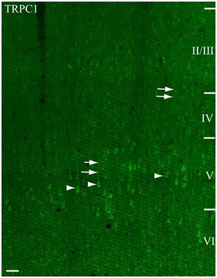 TRPC1 Channels Are Expressed in Pyramidal Neurons and in a Subset of Somatostatin Interneurons in the Rat Neocortex